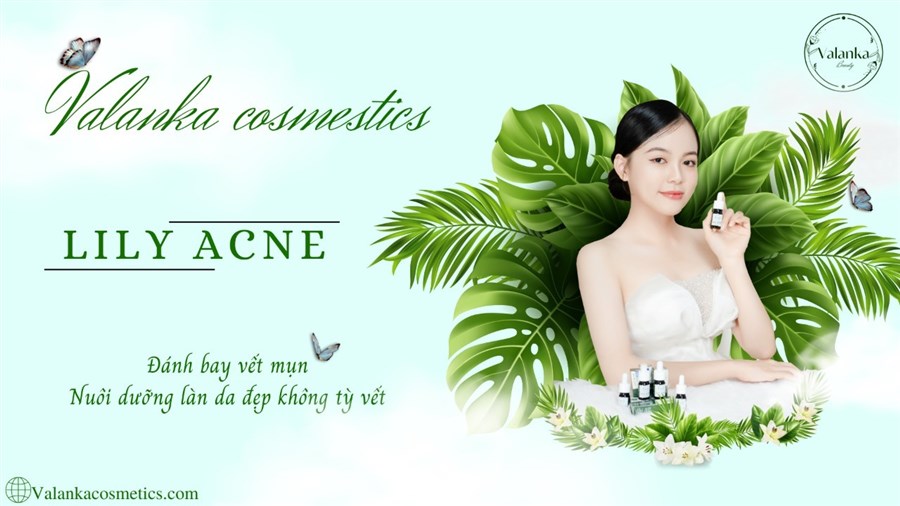 Công ty TNHH Cao Nguyên Hoa Nam: VALANKA BEAUTY – Chinh phục khách hàng từ chất lượng