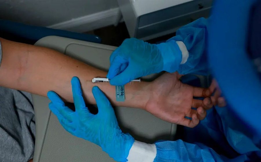 Ca đầu tiên trên thế giới nhiễm cùng lúc HIV, đậu mùa khỉ, Covid